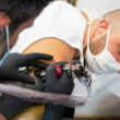 What Happens to Your Skin After Tattoo Removal