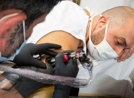 What Happens to Your Skin After Tattoo Removal