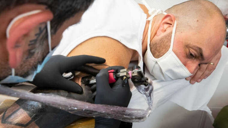 What Happens to Your Skin After Tattoo Removal