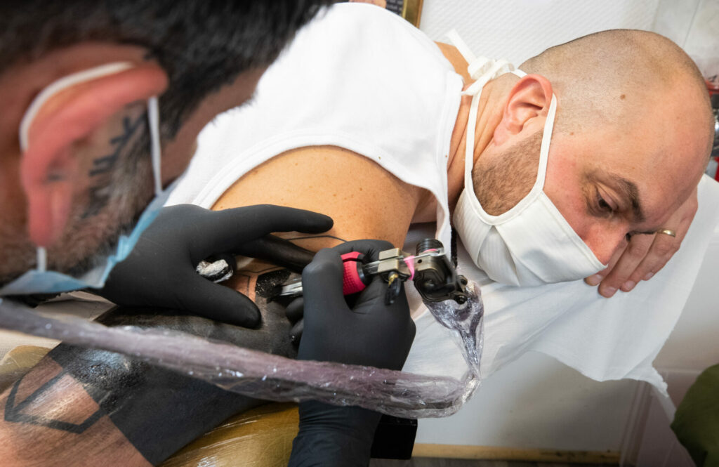 What Happens to Your Skin After Tattoo Removal