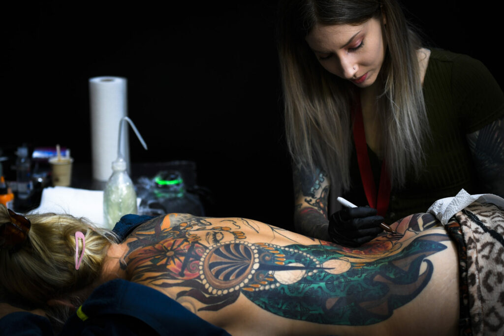 What Happens to Your Skin After Tattoo Removal