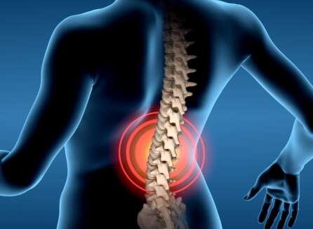lower back pain from epidural years later