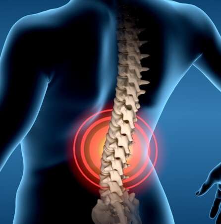lower back pain from epidural years later