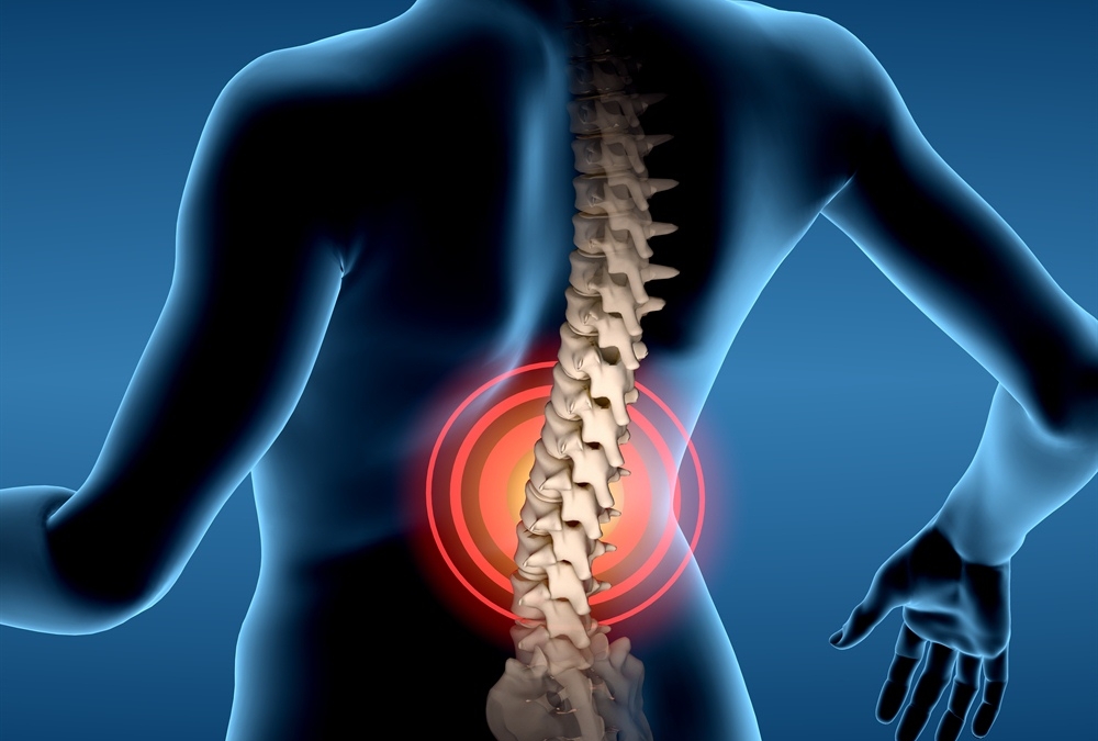 lower back pain from epidural years later