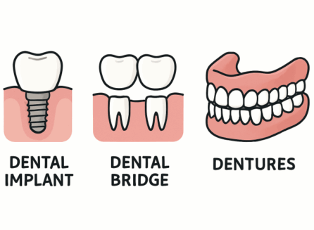 Dental implants Thayer MO